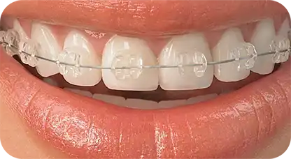 glamyo-dental